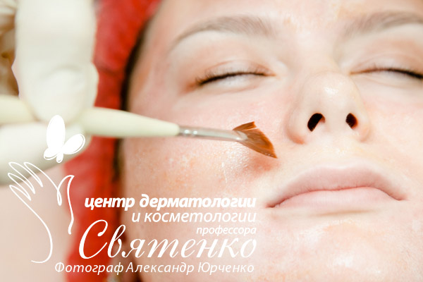 Процедуру химической эксфолиации проводит врач нашего Центра дерматологии и косметологии профессора Святенко.