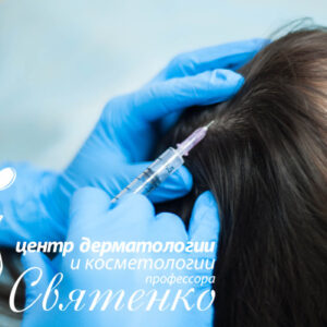 Мезотерапия для лечения волос
